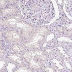Immunohistochemical staining of human kidney shows low expression as expected.