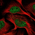 Immunofluorescent staining of human cell line U-2 OS shows localization to nucleoplasm.