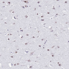Immunohistochemical staining of human cerebral cortex shows strong positivity in nucleoli in neurons.