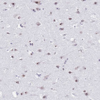 Anti-NOP56 Antibody