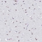 Immunohistochemical staining of human cerebral cortex shows strong positivity in nucleoli in neurons.