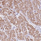Anti-OR4Q3 Antibody