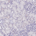 Anti-NOP56 Antibody