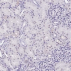 Immunohistochemical staining of human kidney shows weak positivity in nucleoli in cells in tubules.