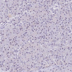 Anti-NOP56 Antibody