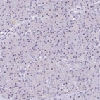 Immunohistochemical staining of human pancreas shows weak positivity in nucleoli in exocrine glandular cells.