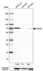 Western blot analysis in U-251MG cells transfected with control siRNA, target specific siRNA probe #1 and #2, using Anti-NOP56 antibody. Remaining relative intensity is presented. Loading control: Anti-GAPDH.