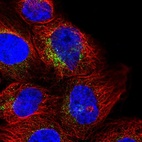 Immunofluorescent staining of human cell line A-431 shows localization to vesicles.