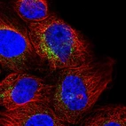 Immunofluorescent staining of human cell line A-431 shows localization to vesicles.