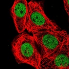 Anti-BCL7B Antibody