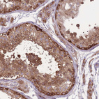 Anti-CCT6A Antibody