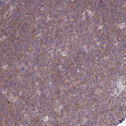 Anti-CCT6A Antibody