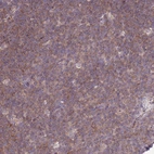 Immunohistochemical staining of human tonsil shows moderate cytoplasmic positivity in germinal center cells.