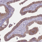 Immunohistochemical staining of human fallopian tube shows moderate cytoplasmic positivity in glandular cells.