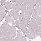 Immunohistochemical staining of human skeletal muscle shows no positivity in myocytes as expected.