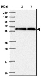 Anti-CCT6A Antibody