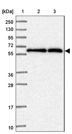 Lane 1: Marker [kDa] 250, 130, 95, 72, 55, 36, 28, 17, 10_br/_Lane 2: Human cell line RT-4_br/_Lane 3: Human cell line U-251MG sp