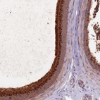 Anti-EDDM3A Antibody