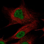Anti-OLFM2 Antibody