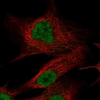 Anti-OLFM2 Antibody