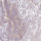 Anti-OR2V2 Antibody