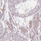 Immunohistochemical staining of human testis shows weak cytoplasmic positivity in Leydig cells.