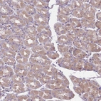 Immunohistochemical staining of human stomach shows weak cytoplasmic positivity in glandular cells.
