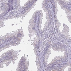 Immunohistochemical staining of human prostate shows no positivity in glandular cells as expected.