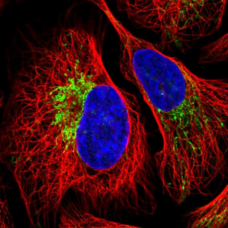 Anti-ZNF211 Antibody