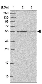 Lane 1: Marker [kDa] 250, 130, 95, 72, 55, 36, 28, 17, 10_br/_Lane 2: Human cell line RT-4_br/_Lane 3: Human cell line U-251MG sp