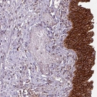 Anti-TUSC3 Antibody