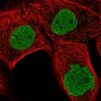 Immunofluorescent staining of human cell line A-431 shows localization to nucleoplasm.