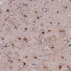 Anti-PFKFB2 Antibody