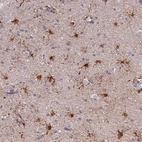 Anti-PFKFB2 Antibody