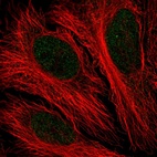 Immunofluorescent staining of human cell line HeLa shows localization to nucleoplasm.