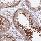 Immunohistochemical staining of human testis shows high expression.