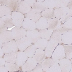 Immunohistochemical staining of human skeletal muscle shows low expression as expected.