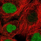 Immunofluorescent staining of human cell line A-431 shows localization to nucleus.
