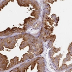 Anti-FAM83C Antibody