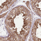 Anti-PRKAR1A Antibody