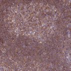 Immunohistochemical staining of human tonsil shows moderate to strong cytoplasmic positivity in non-germinal center cells.