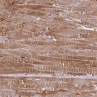 Immunohistochemical staining of human heart muscle shows moderate cytoplasmic positivity in cardiomyocytes.