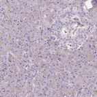 Immunohistochemical staining of human pancreas shows low positivity in exocrine glandular cells as expected.
