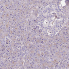 Anti-PRKAR1A Antibody