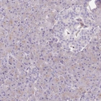 Immunohistochemical staining of human pancreas shows low positivity in exocrine glandular cells as expected.