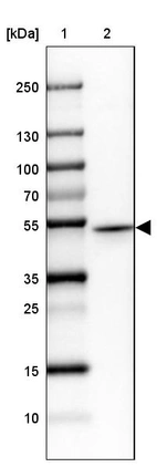 Lane 1: Marker [kDa] 250, 130, 100, 70, 55, 35, 25, 15, 10_br/_Lane 2: Human cell line SK-MEL-30