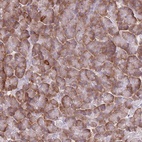 Anti-XKR8 Antibody