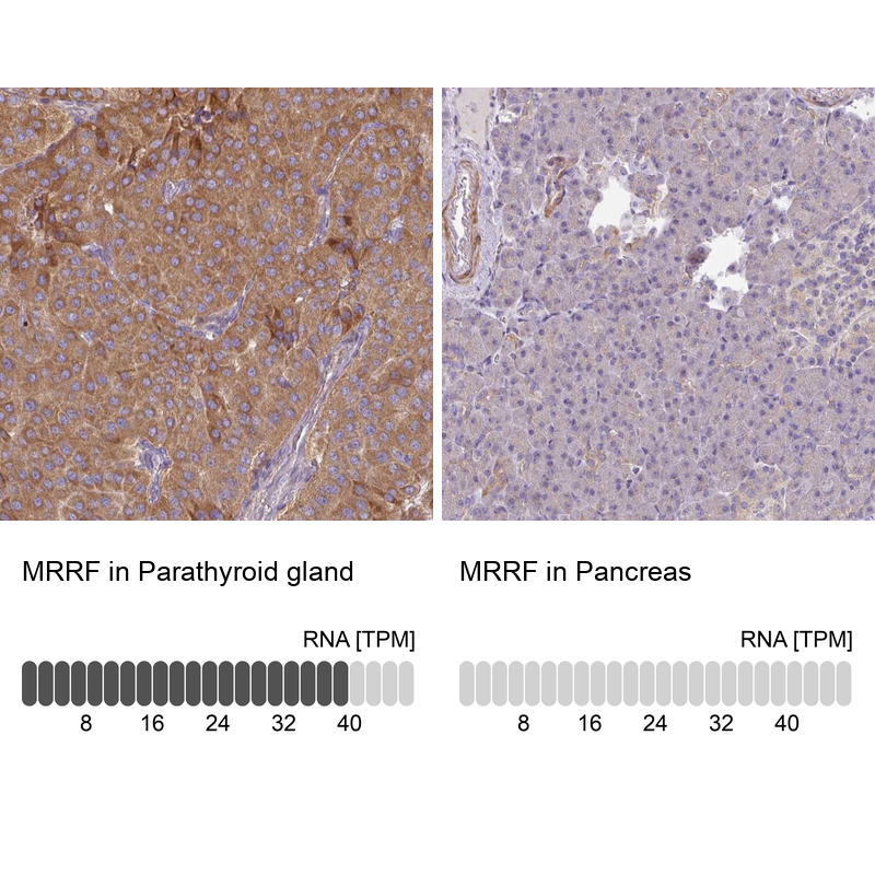 Anti-MRRF Antibody