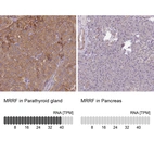 Anti-MRRF Antibody