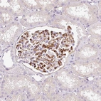 Anti-EHD3 Antibody